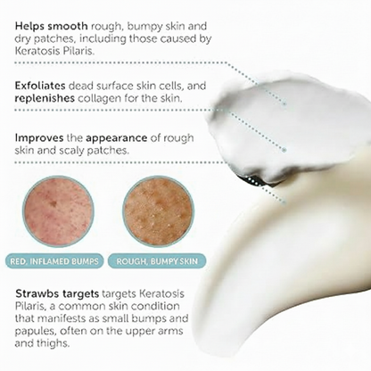 Advanced Triple-Acid Complex for Keratosis Pilaris