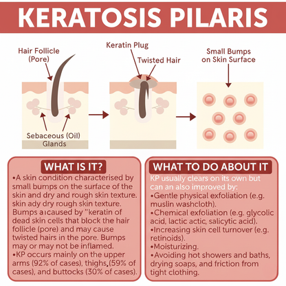Advanced Triple-Acid Complex for Keratosis Pilaris